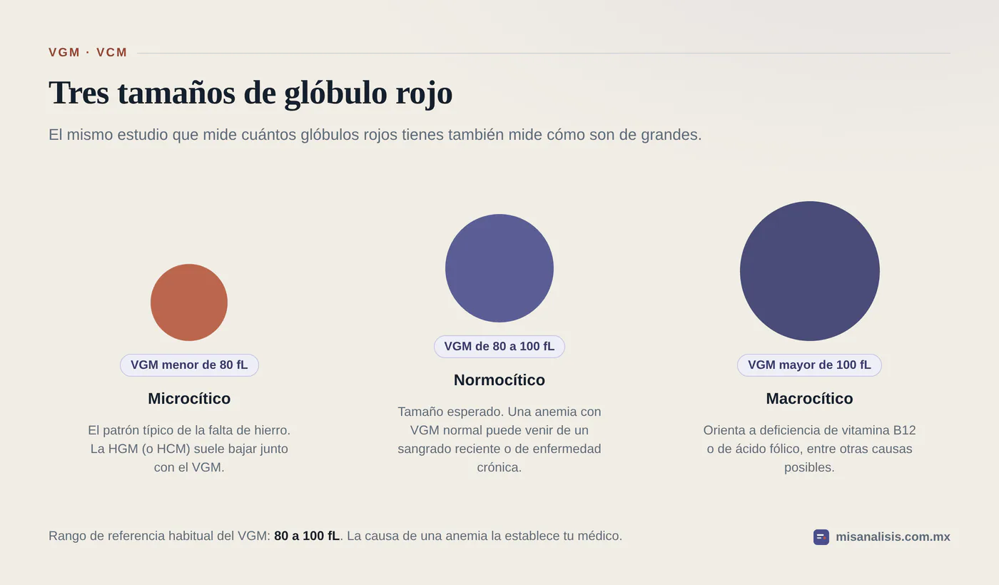 Tres círculos de distinto tamaño que representan glóbulos rojos microcíticos con VGM menor de 80 fL, normocíticos de 80 a 100 fL y macrocíticos por arriba de 100 fL.